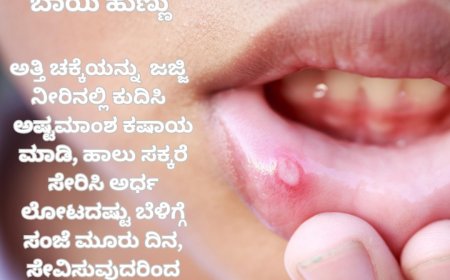 ಬಾಯಿ ಹುಣ್ಣಿಗೆ ಸುಲಭದ ಮದ್ದು