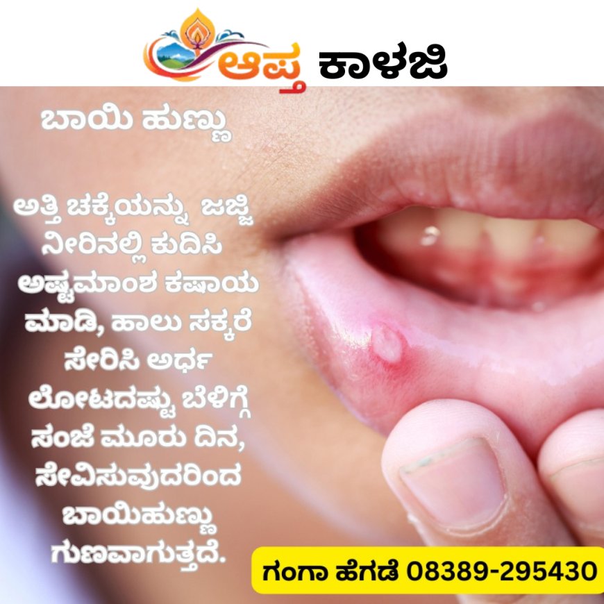 ಬಾಯಿ ಹುಣ್ಣಿಗೆ ಸುಲಭದ ಮದ್ದು