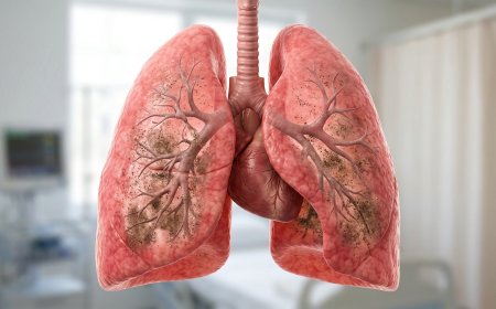 ಹೆದ್ದಾರಿ ಧೂಳಿಗೆ ಹೈರಾಣಾದ ಮಲೆನಾಡು: ಶಿರಸಿ-ಹಾವೇರಿ ರಾಷ್ಟ್ರೀಯ ಹೆದ್ದಾರಿಯಲ್ಲಿ 'ಶ್ವಾಸಕೋಶ ವಿಶೇಷ ಆಸ್ಪತ್ರೆ'ಗೆ ಆಗ್ರಹ