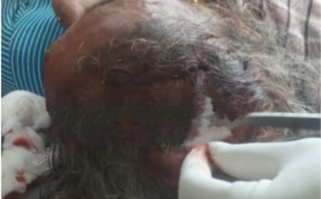 ಜೋಯಿಡಾ: ಚಿರತೆ ದಾಳಿಗೆ ವೃದ್ಧೆ ಬಲಿಪಶು; ರಕ್ತದ ಮಡುವಿನಲ್ಲಿ 70ರ ಹರೆಯದ ಅಜ್ಜಿ!